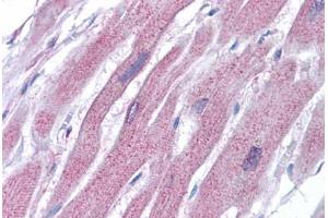 Human Heart: Formalin-Fixed, Paraffin-Embedded (FFPE)