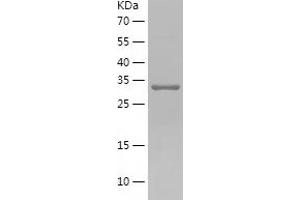 Western Blotting (WB) image for Reticulocalbin 1, EF-Hand Calcium Binding Domain (RCN1) (AA 30-331) protein (His-IF2DI Tag) (ABIN7124833)