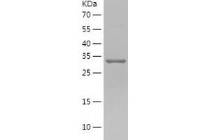 Western Blotting (WB) image for Reticulocalbin 1, EF-Hand Calcium Binding Domain (RCN1) (AA 30-331) protein (His tag) (ABIN7124833)
