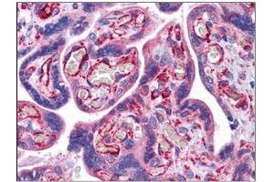 Human Placenta: Formalin-Fixed, Paraffin-Embedded (FFPE) (STAU1/Staufen anticorps  (C-Term))