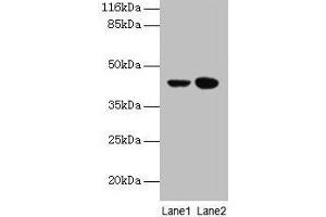 Western blot All lanes: CCR6 antibody at 10 μg/mL Lane 1: MCF-7 whole cell lysate Lane 2: Hela whole cell lysate Secondary Goat polyclonal to rabbit IgG at 1/10000 dilution Predicted band size: 43 kDa Observed band size: 43 kDa (CCR6 anticorps  (AA 322-374))