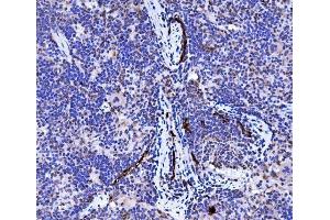 IHC analysis of Podoplanin/gp36/Pdpn using anti-Podoplanin/gp36/Pdpn antibody (ABIN7600811). (Podoplanin anticorps  (AA 24-172))