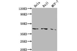 Western Blot Positive WB detected in: Hela whole cell lysate, Raji whole cell lysate, MCF-7 whole cell lysate All lanes: AGTR1 antibody at 1:2000 Secondary Goat polyclonal to rabbit IgG at 1/50000 dilution Predicted band size: 42 kDa Observed band size: 42 kDa