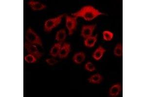 Immunofluorescent analysis of MBTPS1 staining in SKOV3 cells.