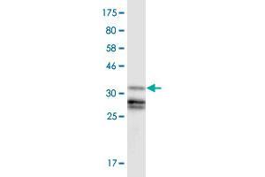 Western Blot detection against Immunogen (37. (GLI3 anticorps  (AA 1-110))