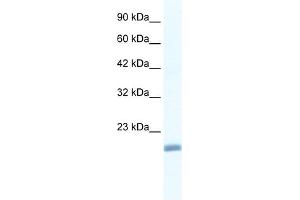 WB Suggested Anti-EDF1 Antibody Titration:  1. (EDF1 anticorps  (N-Term))