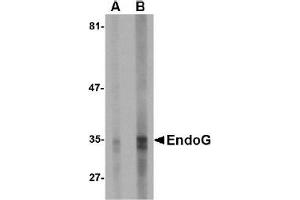 Western Blotting (WB) image for anti-Endonuclease G (ENDOG) (AA 51-140) antibody (ABIN492522) (Endonuclease G anticorps  (AA 51-140))