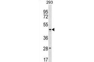 Western Blotting (WB) image for anti-Family with Sequence Similarity 155, Member B (FAM155B) antibody (ABIN3000232) (FAM155B anticorps)