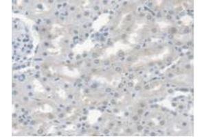 Detection of CES1 in Rat Kidney Tissue using Polyclonal Antibody to Carboxylesterase 1 (CES1) (CES1 anticorps  (AA 19-300))