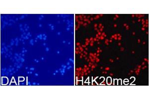 Immunofluorescence analysis of 293T cells using DiMethyl-Histone H4-K20 antibody.