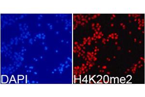 Immunofluorescence analysis of 293T cells using DiMethyl-Histone H4-K20 antibody. (Histone H4 anticorps  (2meLys20))