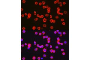 Immunofluorescence analysis of THP-1 cells using CD11b/ITGAM Rabbit pAb (ABIN3022179, ABIN3022180, ABIN3022181 and ABIN6218650) at dilution of 1:100 (40x lens).