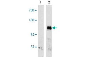 Western blot analysis of EPHA3 (arrow) using EPHA3 polyclonal antibody . (EPH Receptor A3 anticorps  (C-Term))