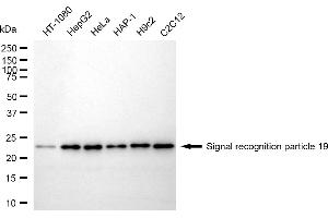 Western blotting analysis using Signal recognition particle 19 antibody (ABIN7800331).
