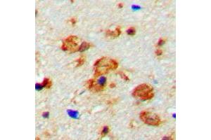 anti-CaMK2 beta/gamma (pSer287) antibody