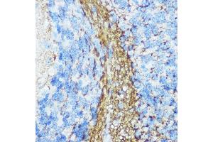 Immunohistochemistry of paraffin-embedded mouse brain using Neurofilament M Rabbit pAb (ABIN7268865) at dilution of 1:100 (40x lens).