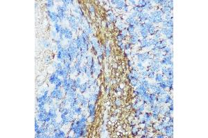 Immunohistochemistry of paraffin-embedded mouse brain using Neurofilament M Rabbit pAb (ABIN7268865) at dilution of 1:100 (40x lens). (NEFM anticorps  (AA 200-300))