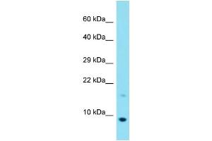Host: Rabbit Target Name: C20orf166 Sample Type: MCF7 Whole Cell lysates Antibody Dilution: 1.