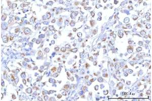 IHC analysis of PTPIP51/RMDN3 using anti-PTPIP51/RMDN3 antibody (ABIN7601775). (RMDN3 anticorps  (AA 45-438))