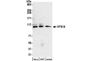 Western Blotting (WB) image for anti-Vacuolar Protein Sorting 18 Homolog (VPS18) (AA 900-950) antibody (ABIN7450898)
