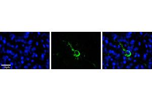 Rabbit Anti-LPIN1 Antibody  Catalog Number: ARP53826_P050  Formalin Fixed Paraffin Embedded Tissue: Human Pineal Tissue  Observed Staining: Cytoplasmic and membrane in cell bodies and processes of pinealocytes  Primary Antibody Concentration: 1:100  Other Working Concentrations: 1/600  Secondary Antibody: Donkey anti-Rabbit-Cy3  Secondary Antibody Concentration: 1:200  Magnification: 20X  Exposure Time: 0.