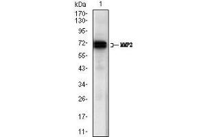 Western blot analysis using MMP2 mouse mAb against A431 (1) cell lysate. (MMP2 anticorps  (AA 242-396))