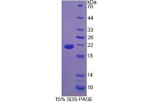 SDS-PAGE analysis of Human IHH Protein.