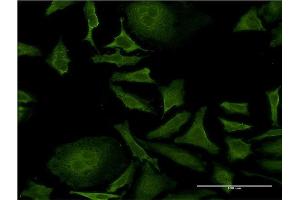 Immunofluorescence of monoclonal antibody to ISCU on HeLa cell. (ISCU anticorps  (AA 26-167))