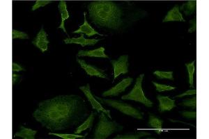 Immunofluorescence of monoclonal antibody to ISCU on HeLa cell. (ISCU anticorps  (AA 26-167))
