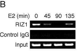 ChIP analysis of estrogen target genes. (PRDM2 anticorps  (AA 1-347))