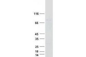 Validation with Western Blot