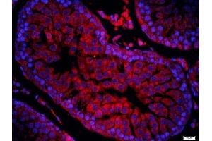 Paraformaldehyde-fixed, paraffin embedded rat testis tissue, Antigen retrieval by boiling in sodium citrate buffer(pH6) for 15min, Block endogenous peroxidase by 3% hydrogen peroxide for 30 minutes, Blocking buffer (normal goat serum) at 37°C for 20min, Antibody incubation with Rabbit Anti-ERCC1 Polyclonal Antibody, Unconjugated  at 1:200 overnight at 4°C, followed by a conjugated secondary and DAB staining