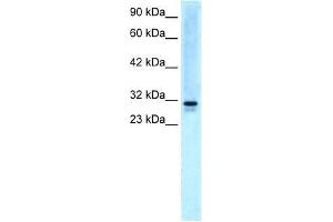Human HepG2; WB Suggested Anti-EAP30 Antibody Titration: 5.
