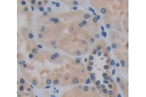 IHC-P analysis of Human Tissue, with DAB staining. (INHBB anticorps  (AA 293-407))