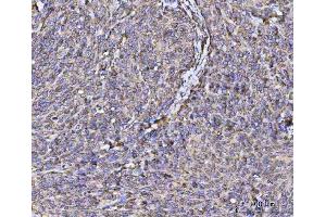IHC analysis of RPL36 using anti-RPL36 antibody (ABIN7602917). (RPL36 anticorps  (C-Term))