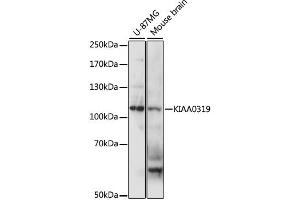 Western blot analysis of extracts of various cell lines, using KIAA0319 antibody (ABIN6290542) at 1:1000 dilution. (KIAA0319 anticorps)