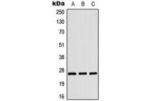 Western blot analysis of Tumstatin expression in HepG2 colchicine-treated (A), HeLa UV-treated (B), Raw264. (COL4a3 anticorps  (C-Term))