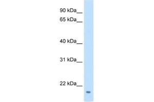 Western Blotting (WB) image for anti-Family with Sequence Similarity 107, Member A (FAM107A) antibody (ABIN2462571) (FAM107A anticorps)