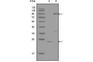 Western blot analysis using YES1 mouse mAb against truncated YES1-His recombinant protein (1) and full-length GFP-YES1(aa1-543) transfected COS7 cell lysate (2). (YES1 anticorps  (AA 10-193))
