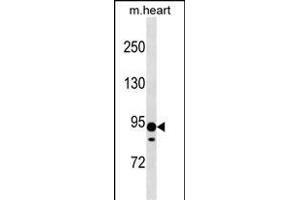 XYLT2 Antibody (N-term) (ABIN1539270 and ABIN2838180) western blot analysis in mouse heart tissue lysates (35 μg/lane).
