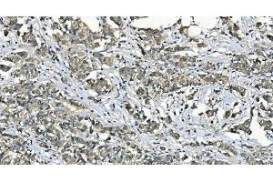 IHC analysis of EEF2/Elongation factor 2 using anti-EEF2/Elongation factor 2 antibody (ABIN7603142). (EEF2 anticorps  (N-Term))