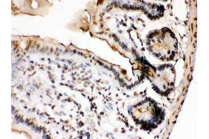 Immunohistochemistry (Paraffin-embedded Sections) (IHC (p)) image for anti-FBJ Murine Osteosarcoma Viral Oncogene Homolog B (FOSB) (AA 264-291), (C-Term) antibody (ABIN3042399)