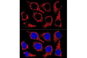 Confocal immunofluorescence analysis of HeLa cells using TOM20 Rabbit mAb (ABIN7268554) at dilution of 1:100.