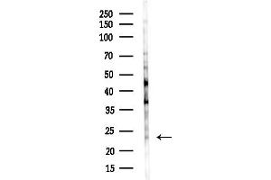 anti-A Kinase (PRKA) Anchor Protein 14 (AKAP14) (N-Term) antibody