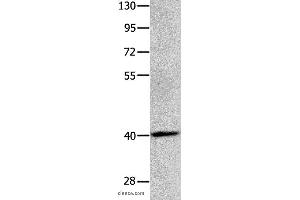 Western blot analysis of Human brain glioma tissue, using MAGEB4 Polyclonal Antibody at dilution of 1:550 (MAGEB4 anticorps)