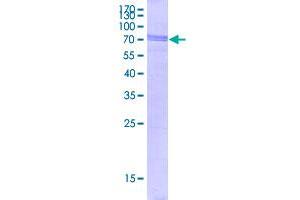 Image no. 1 for TAR DNA Binding Protein (TARDBP) (AA 1-414) protein (GST tag) (ABIN4888948)