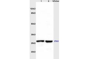 Lane 1: mouse liver lysates Lane 2: mouse brain lysates probed with Anti MS4A2 Polyclonal Antibody, Unconjugated (ABIN1715142) at 1:200 in 4 °C. (MS4A2 anticorps  (AA 51-150))