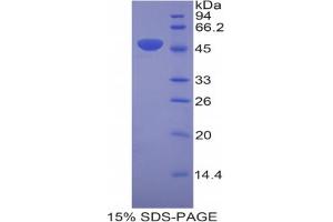 SDS-PAGE analysis of Mouse Laminin gamma 2 Protein. (LAMC2 Protéine)