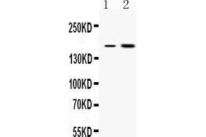 Western blot analysis of CSB expression in rat liver extract ( Lane 1) and COLO320 whole cell lysates ( Lane 2). (ERCC6 anticorps  (N-Term))