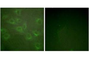 Immunofluorescence analysis of HuvEc cells, using Kv1.